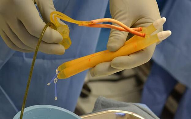 Penis implants